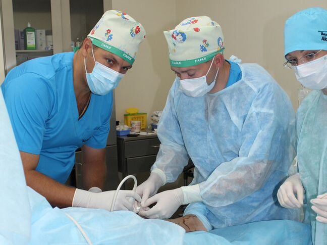chirurgia per le vene varicose